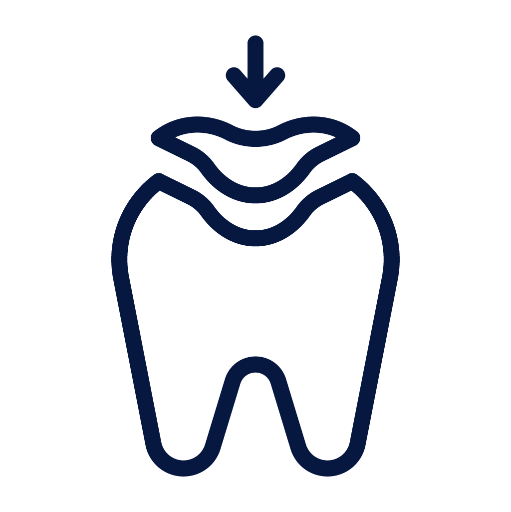 Porcelain Veneers